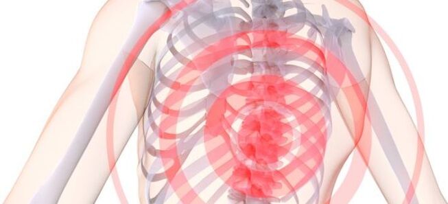 LOKASYON SA SOIN SA BREAST CHONDROSISOS