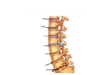 Mga Sintomas sa Osteochondrosis
