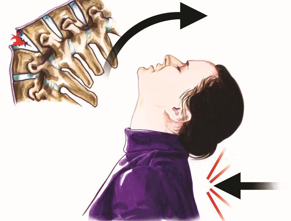 kadaot sa taludtod isip hinungdan sa kasakit sa liog