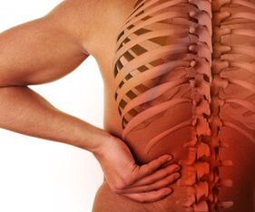 sakit sa likod nga adunay lumbar osteochondrosis