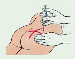 indeyksiyon alang sa pagtambal sa osteochondrosis